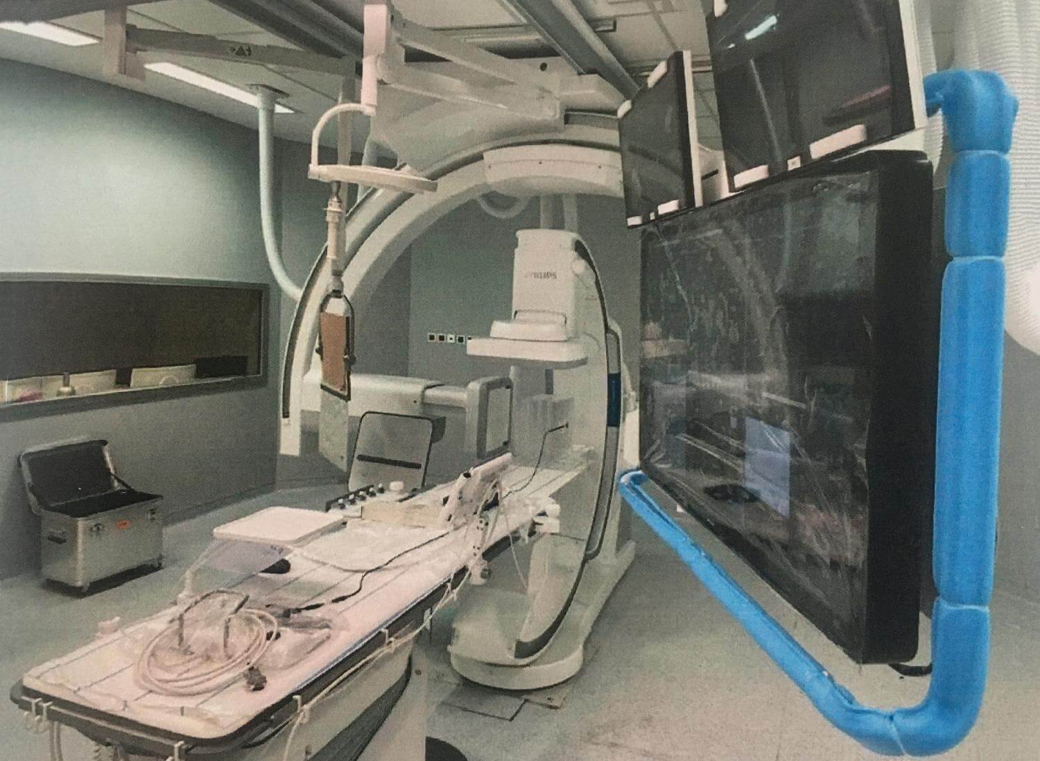 DIGITAL BIPLANE ANGIOGRAPHY DEVICE